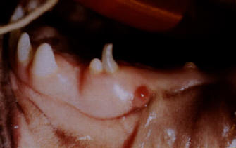 deciroot abscess