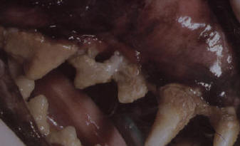 Dental Severe2