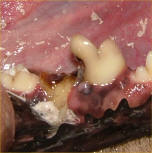 Dentalcaries2